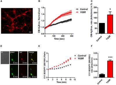 Calcium Deregulation: Novel Insights to Understand Friedreich’s Ataxia Pathophysiology